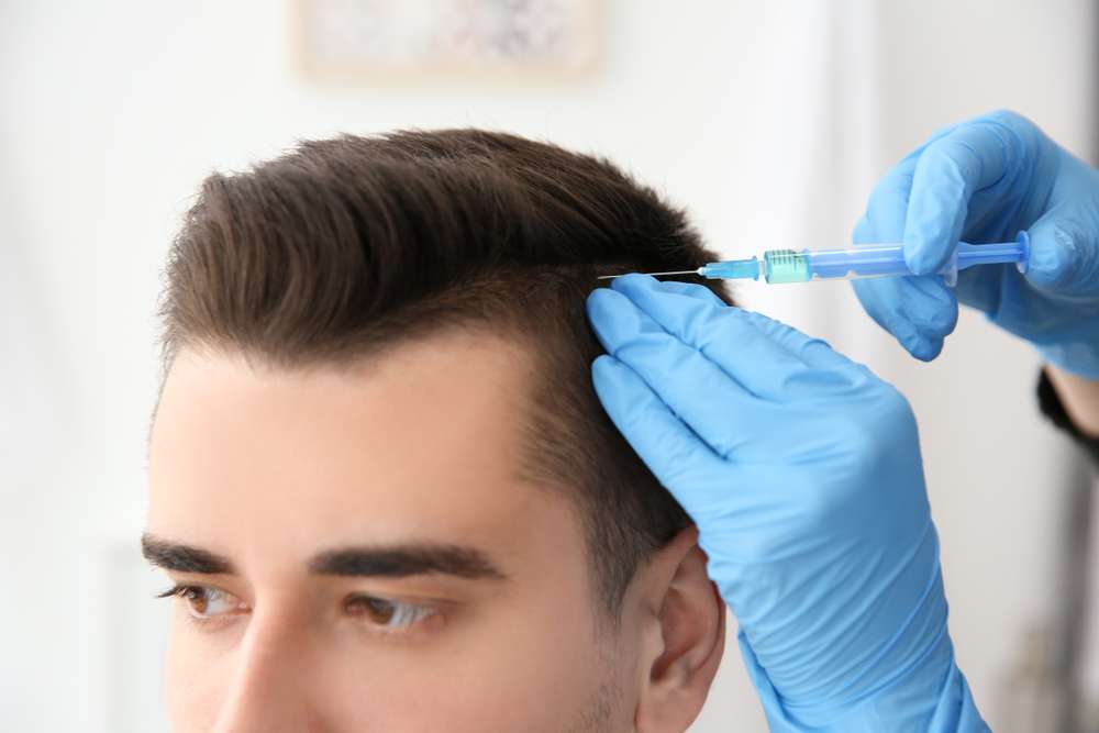 Haartransplantation klinik vs. Perücken: Was ist die bessere Wahl?