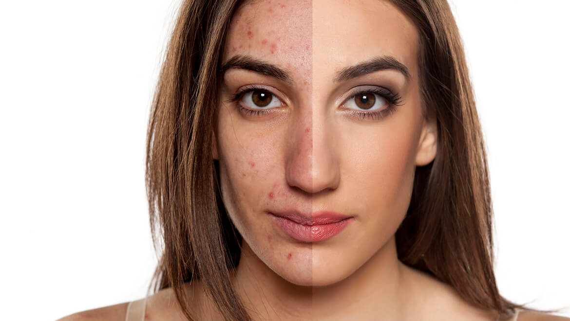Jetzt Torriden kaufen – Hochwertige K-Beauty-Produkte bestellen