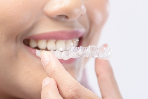 Langfristige Zahngesundheit mit Zahnarzt ZĂŒrich