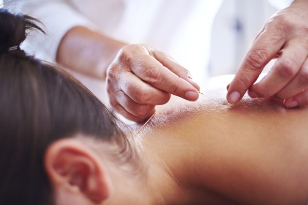 Akupunktura a mindennapi jĂłlĂ©tĂ©rt â Akupunkturbehandlungen usw